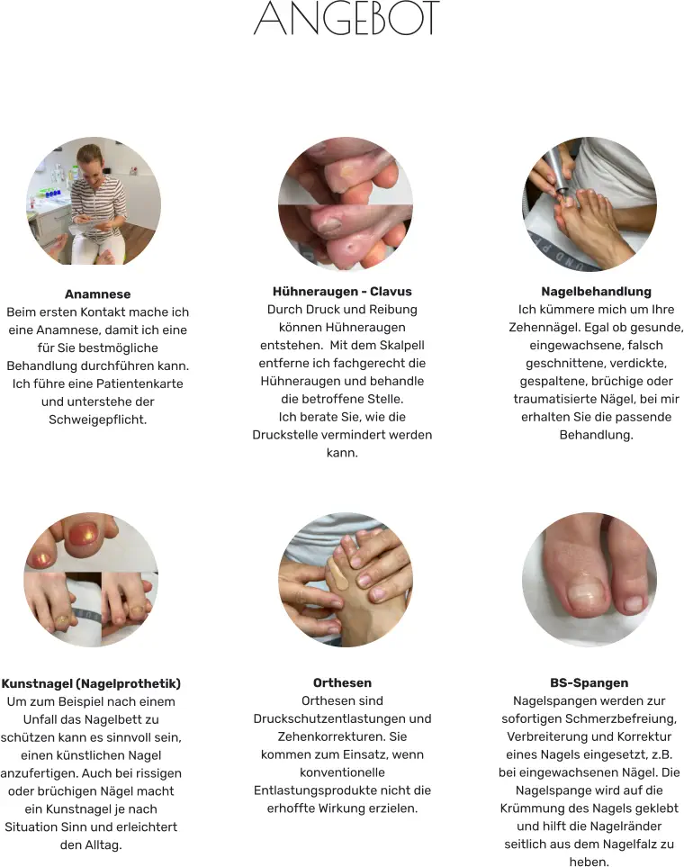 BS-Spangen Nagelspangen werden zur sofortigen Schmerzbefreiung, Verbreiterung und Korrektur eines Nagels eingesetzt, z.B. bei eingewachsenen Nägel. Die Nagelspange wird auf die Krümmung des Nagels geklebt und hilft die Nagelränder seitlich aus dem Nagelfalz zu heben. Orthesen Orthesen sind Druckschutzentlastungen und Zehenkorrekturen. Sie kommen zum Einsatz, wenn konventionelle Entlastungsprodukte nicht die erhoffte Wirkung erzielen. Anamnese Beim ersten Kontakt mache ich eine Anamnese, damit ich eine für Sie bestmögliche Behandlung durchführen kann. Ich führe eine Patientenkarte und unterstehe der Schweigepflicht. Nagelbehandlung  Ich kümmere mich um Ihre Zehennägel. Egal ob gesunde, eingewachsene, falsch geschnittene, verdickte, gespaltene, brüchige oder traumatisierte Nägel, bei mir erhalten Sie die passende Behandlung. Hühneraugen - Clavus  Durch Druck und Reibung können Hühneraugen entstehen.  Mit dem Skalpell entferne ich fachgerecht die Hühneraugen und behandle die betroffene Stelle. Ich berate Sie, wie die Druckstelle vermindert werden kann. Kunstnagel (Nagelprothetik) Um zum Beispiel nach einem Unfall das Nagelbett zu schützen kann es sinnvoll sein, einen künstlichen Nagel anzufertigen. Auch bei rissigen oder brüchigen Nägel macht ein Kunstnagel je nach Situation Sinn und erleichtert den Alltag.  ANGEBOT